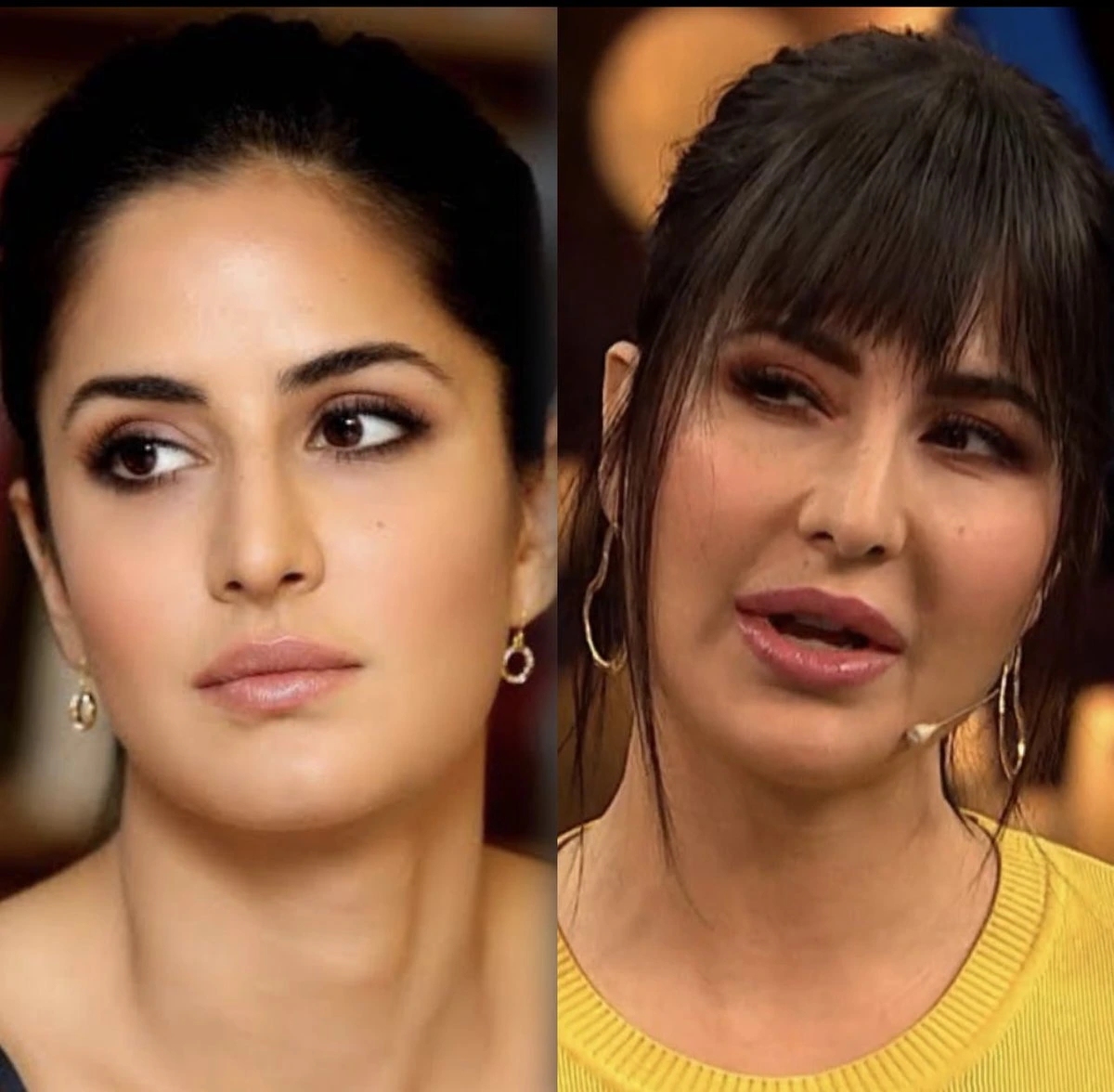 katrina kaif plastic surgery